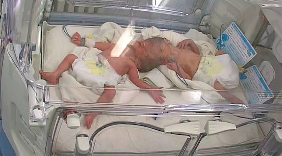 Nu pot fi separaţi!