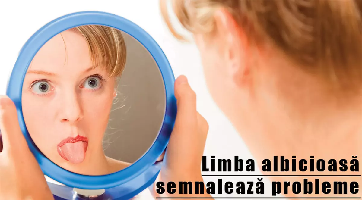 Limba îţi spune ce boli ai