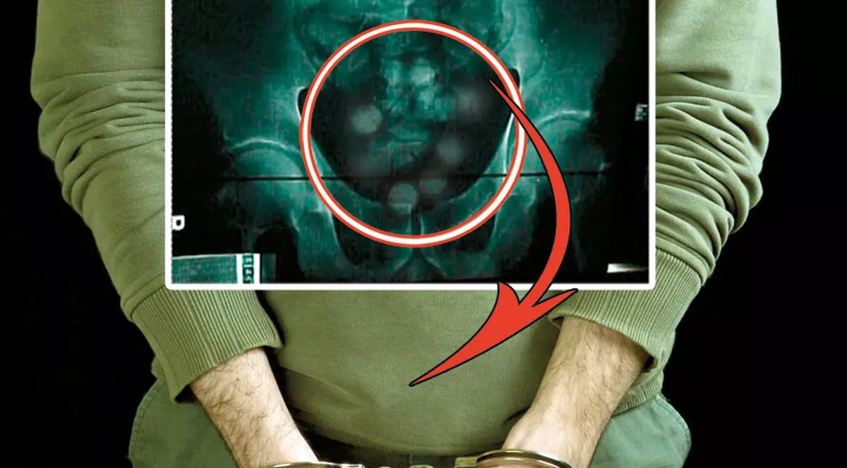 Aşa arată cocaina în burta unui cărăuş