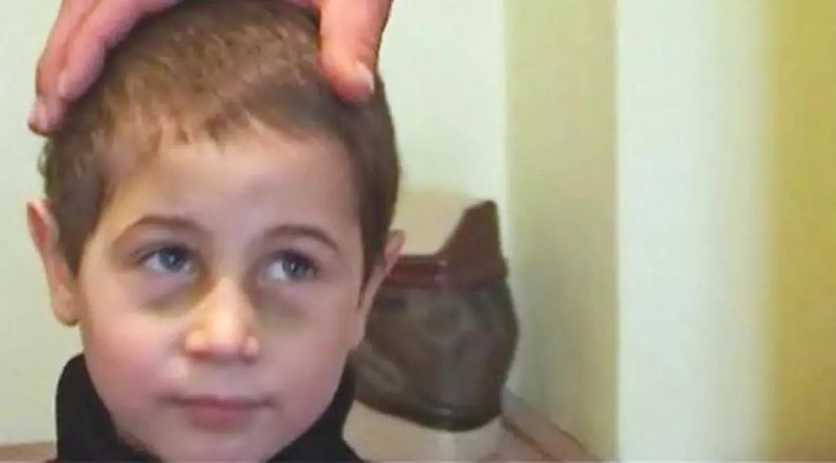 Educatoarea l-a dat cu capul de masă