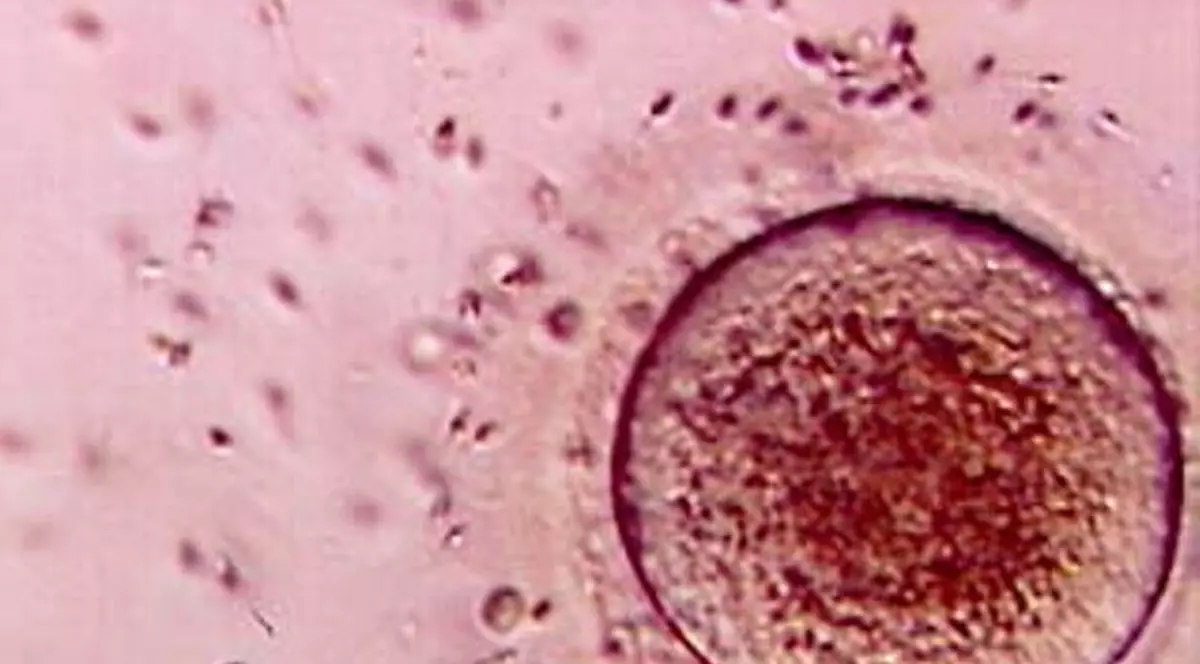 Băncile de spermă o duc bine pe criză 