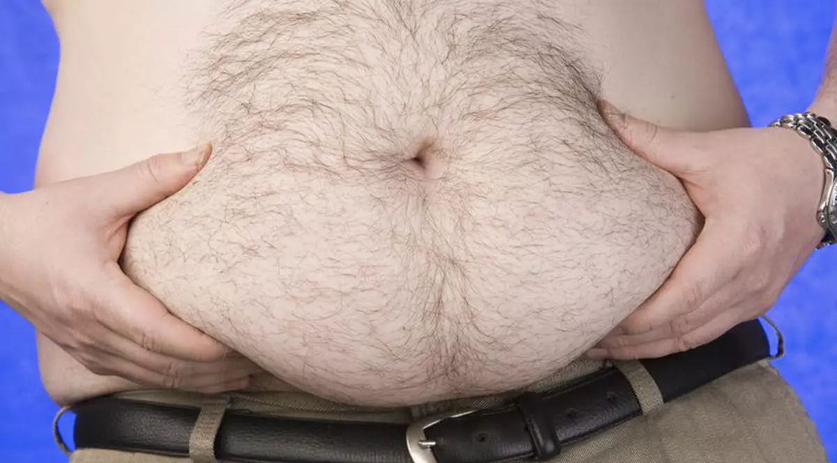 Trupă de balet pentru grăsani