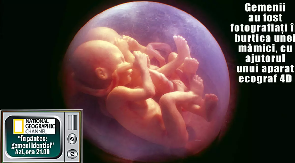 Înghesuiţi în burtică