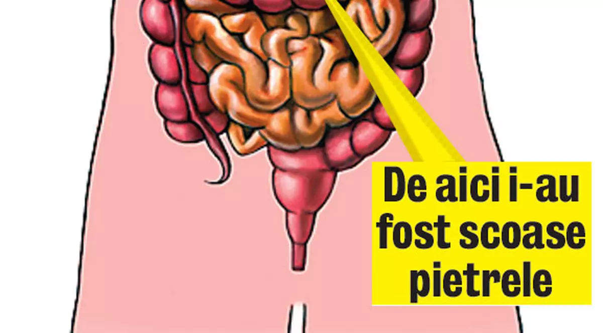 Ilie Sârbu, din nou la cuţit