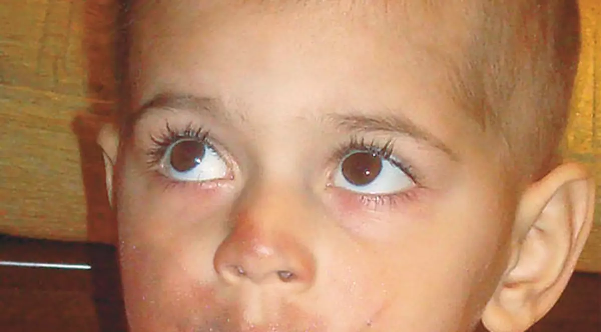 Dennis a învins cancerul