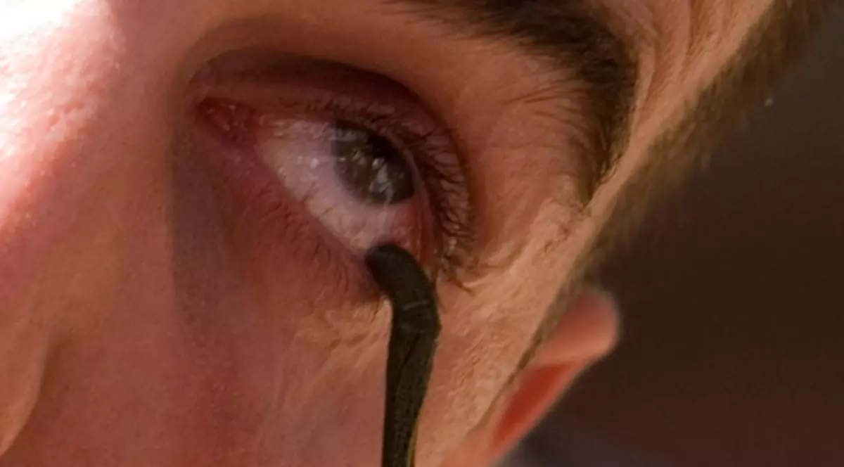 I-a intrat o lipitoare în ochi