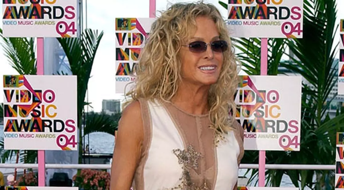 Farrah Fawcett, în stare gravă