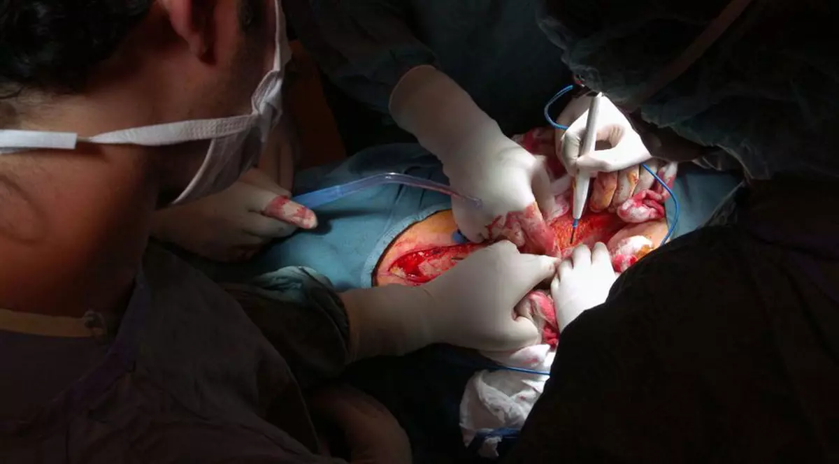 Românii îşi vând organele pe internet, în Spania 