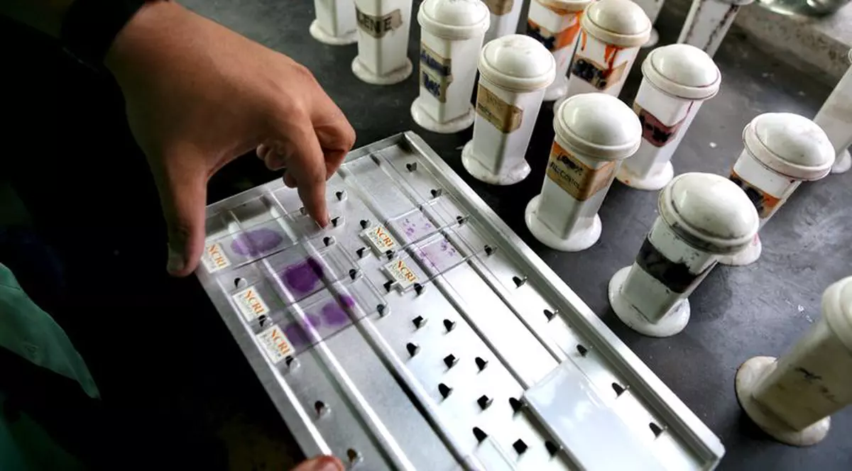 Bătrânii ar putea fi imuni la gripa porcină