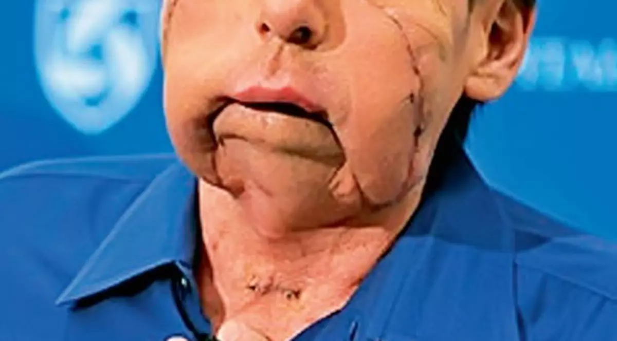 Un american a primit o nouă faţă