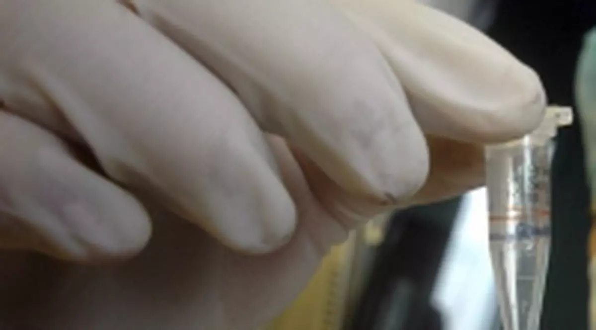 19.273 de persoane infestate cu virusul H1N1