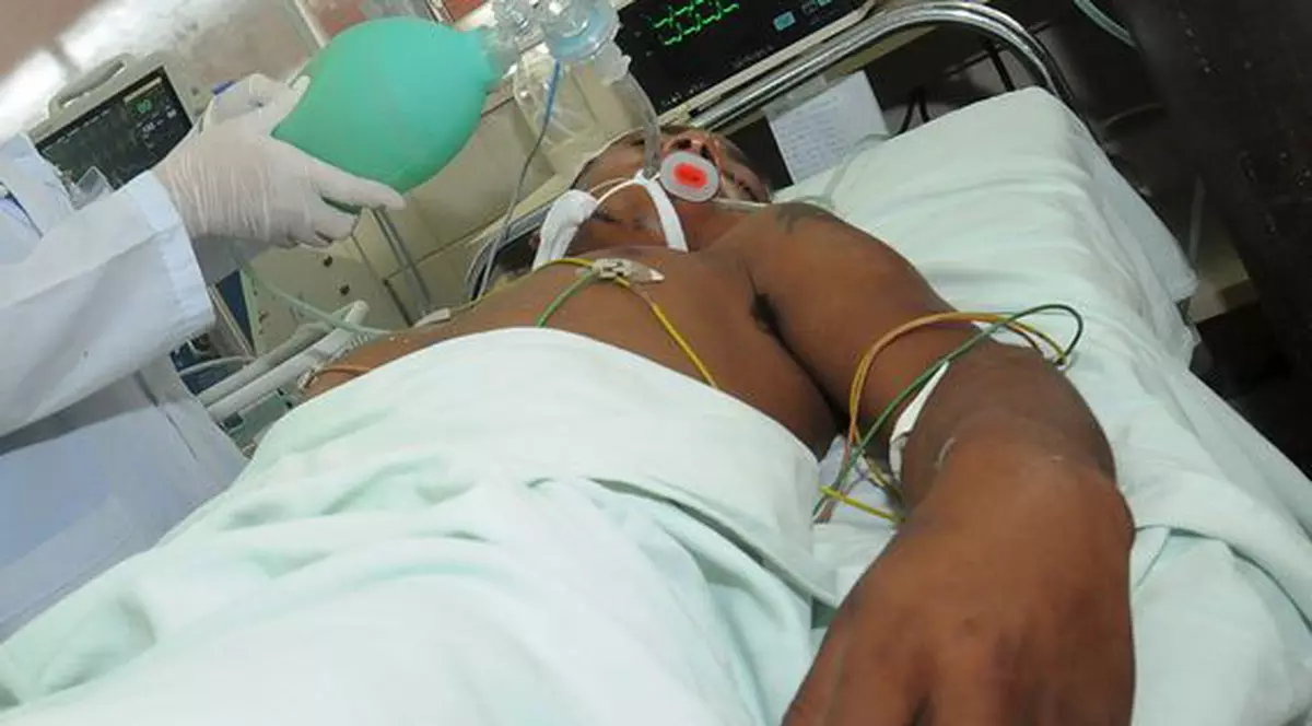 Un bărbat care a suferit un transplant de faţă şi mâini a murit