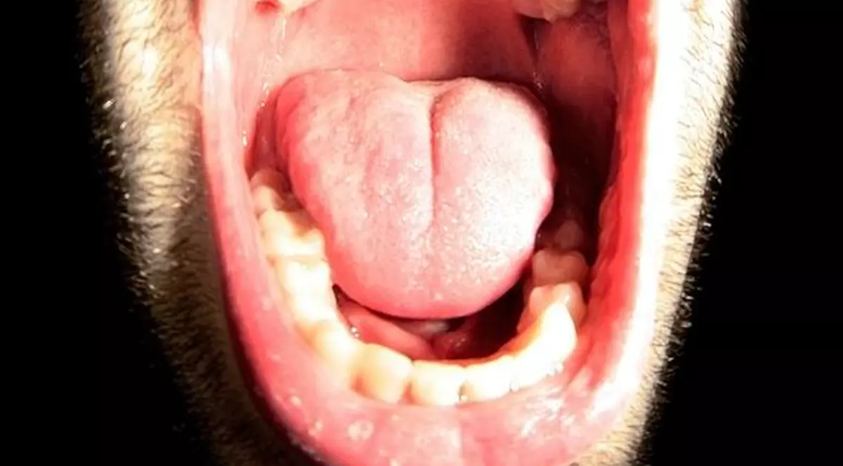 Şoferii se muşcă între ei în trafic