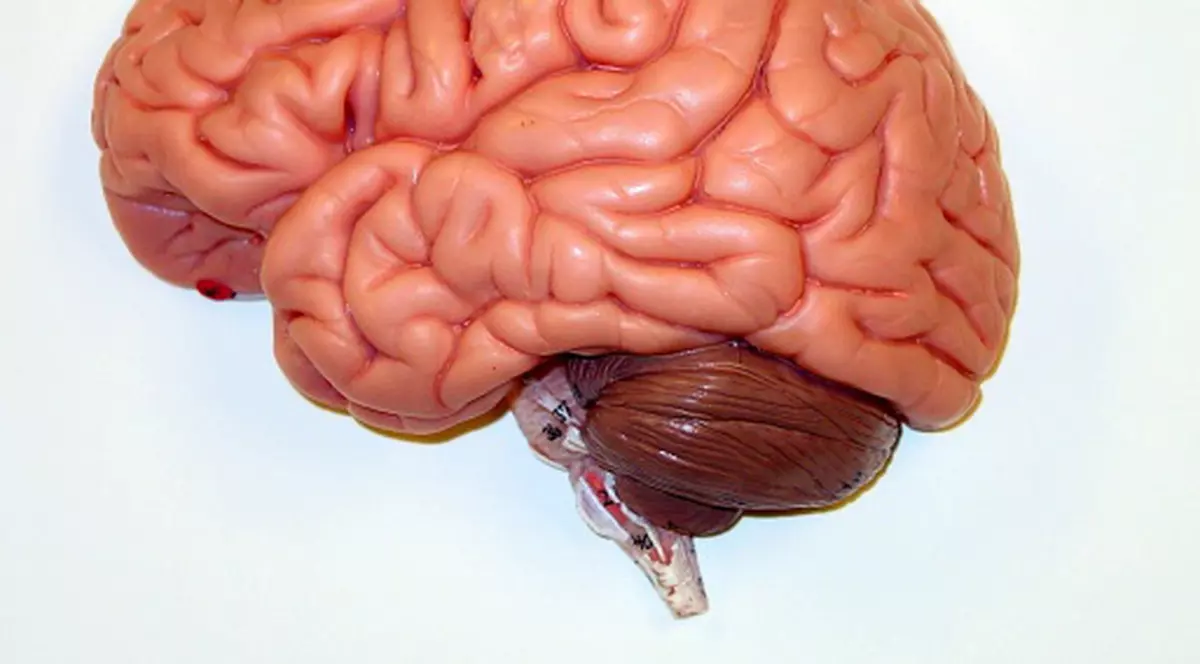 Michael, înmormântat fără creier