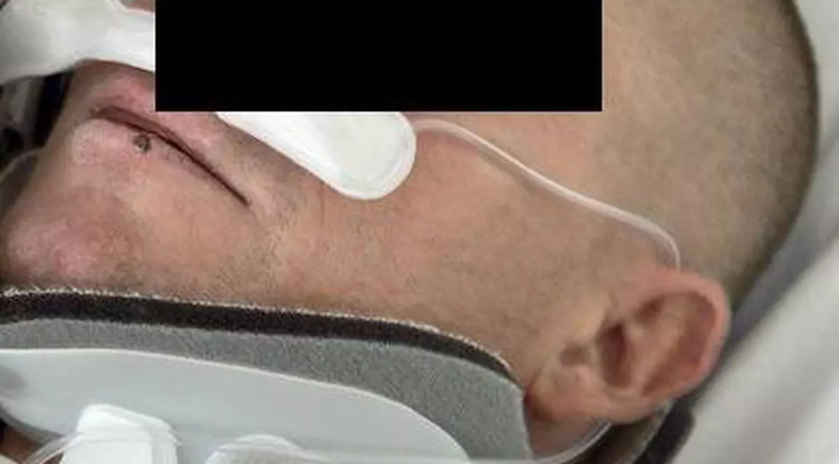 A căzut în somn de la etajul 4 