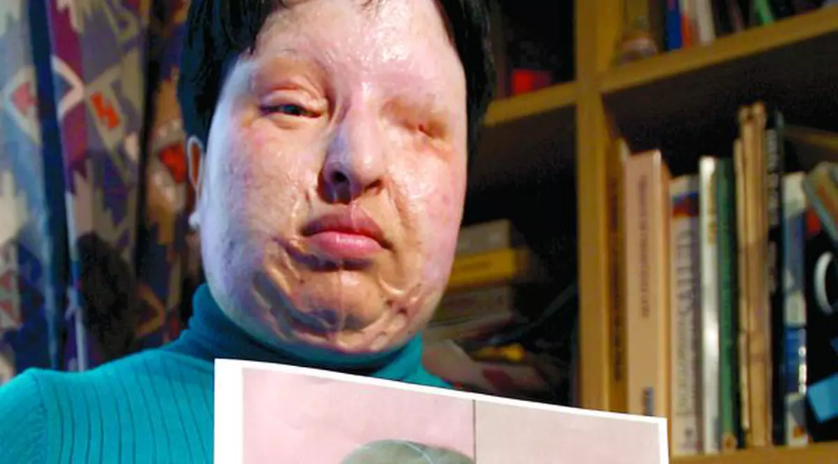 Îi va turna pe faţă fostului iubit acid sulfuric