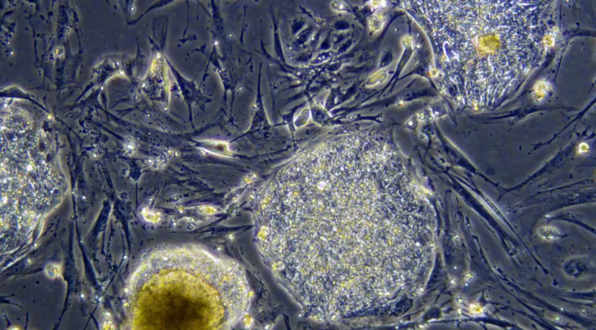 Vaccinul împotriva gripei porcine este cancerigen?