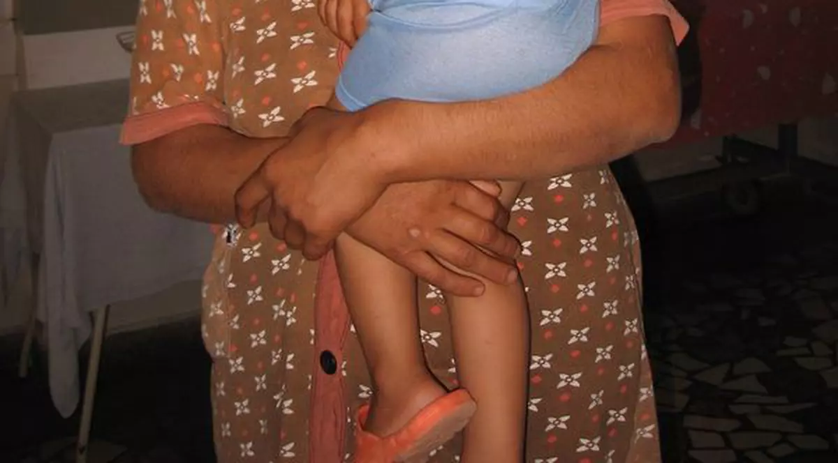 Copil de 3 ani, desfigurat de ciobănescul din bătătură