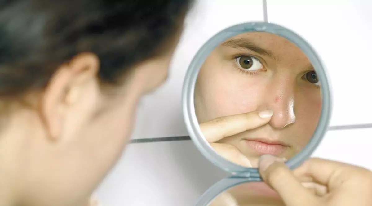 10 sfaturi ca să scapi de coşuri