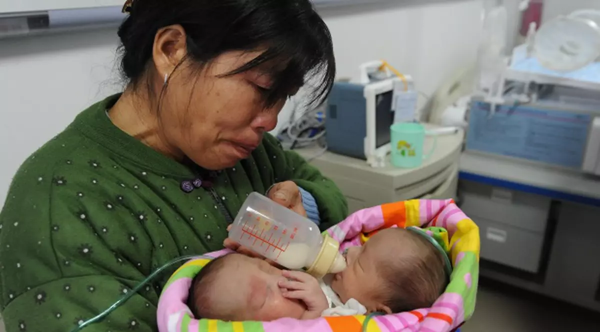 Medicii credeau că sunt gemeni, dar erau siamezi care împart o singură inimă