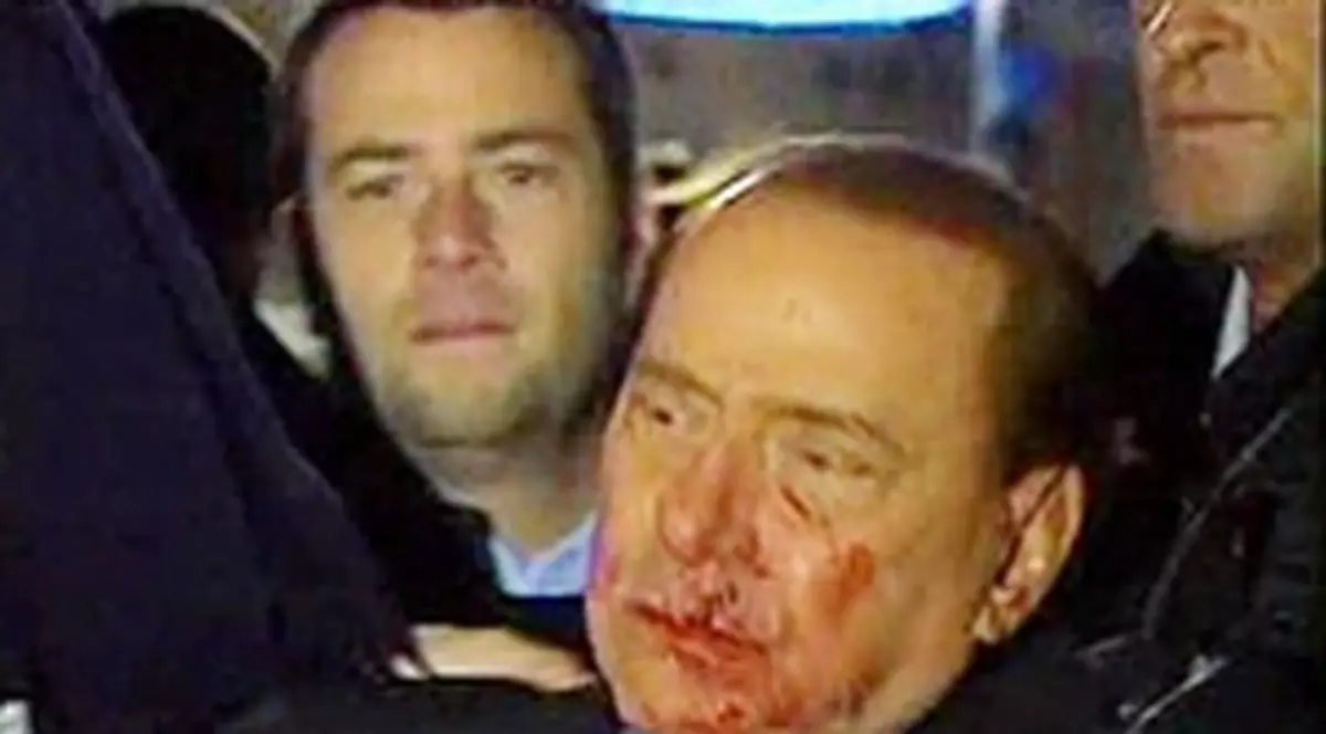 Berlusconi rămâne în spital din cauza durerilor persistente