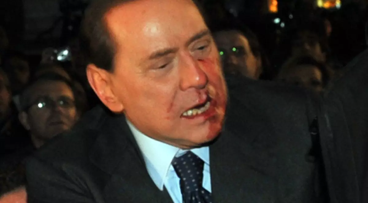 Google a şters pozele cu atacul la Berlusconi
