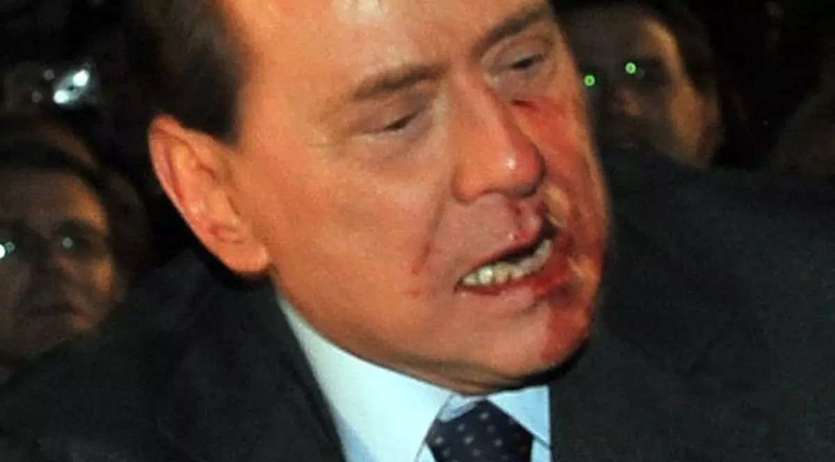 Berlusconi a pierdut jumătate de litru de sânge