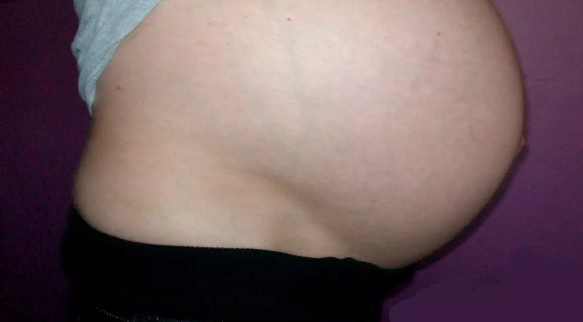 A născut pe o autostradă din Italia 