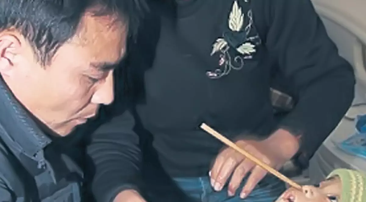 La un pas de moarte după ce i s-a înfipt un băţ în creier