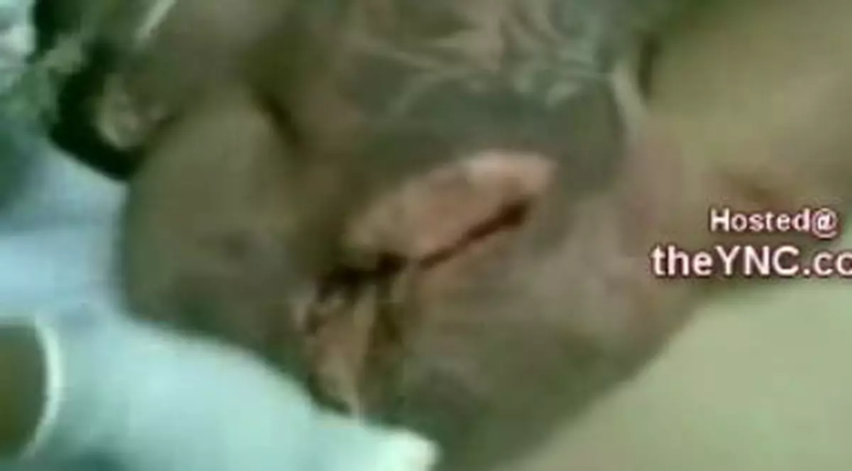 Video şocant! Şi-a injectat steroizi în braţe până a murit 