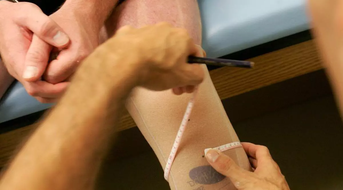 Un pacient britanic s-a trezit cu două picioare stângi