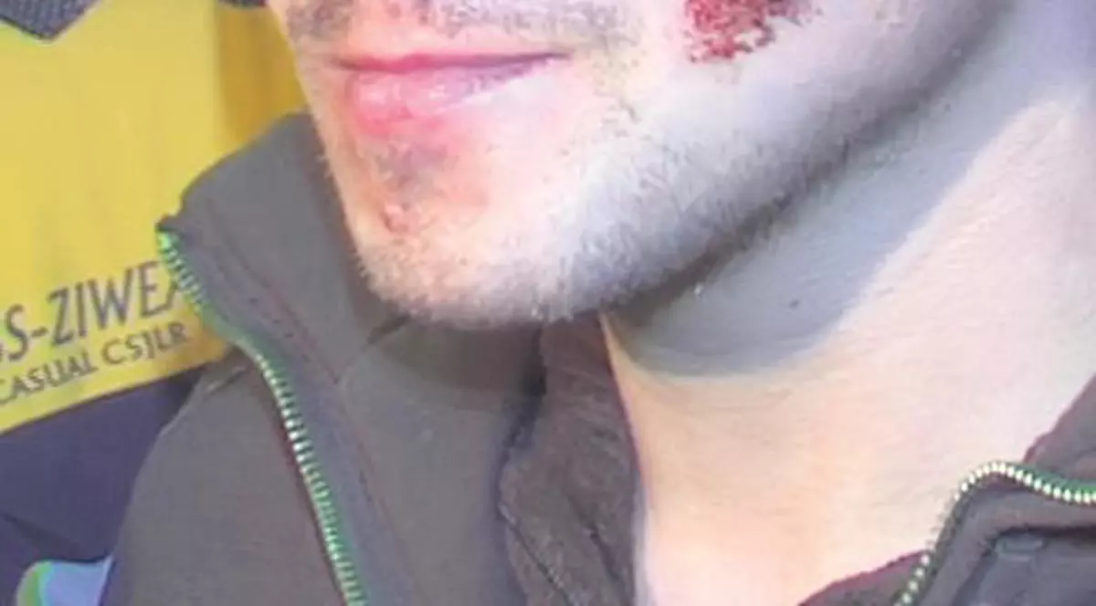 I-a zdrobit capul fostei iubite pentru că l-a părăsit