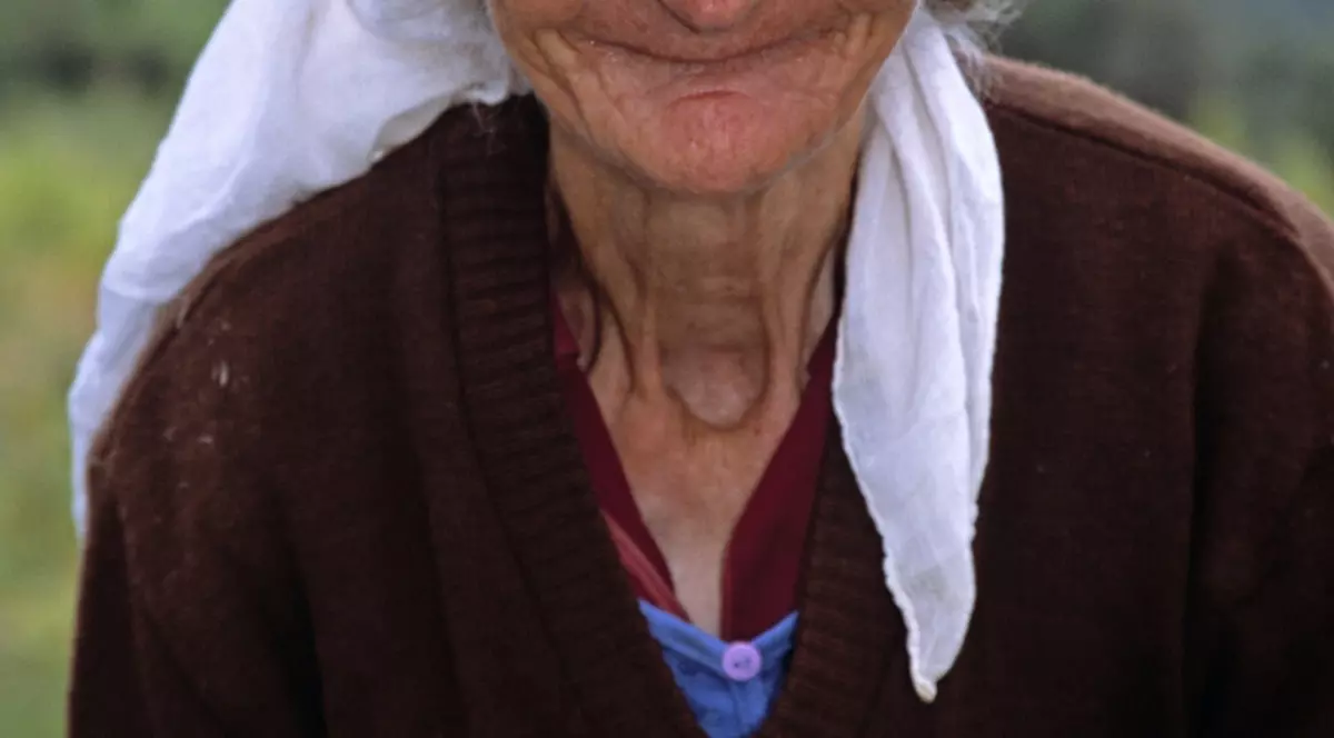 A primit o proteză nouă la 104 ani