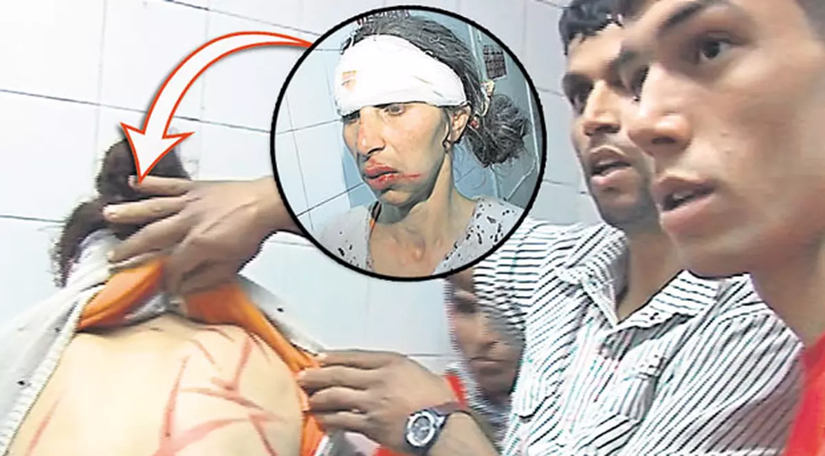 În ce hal i-au bătut!