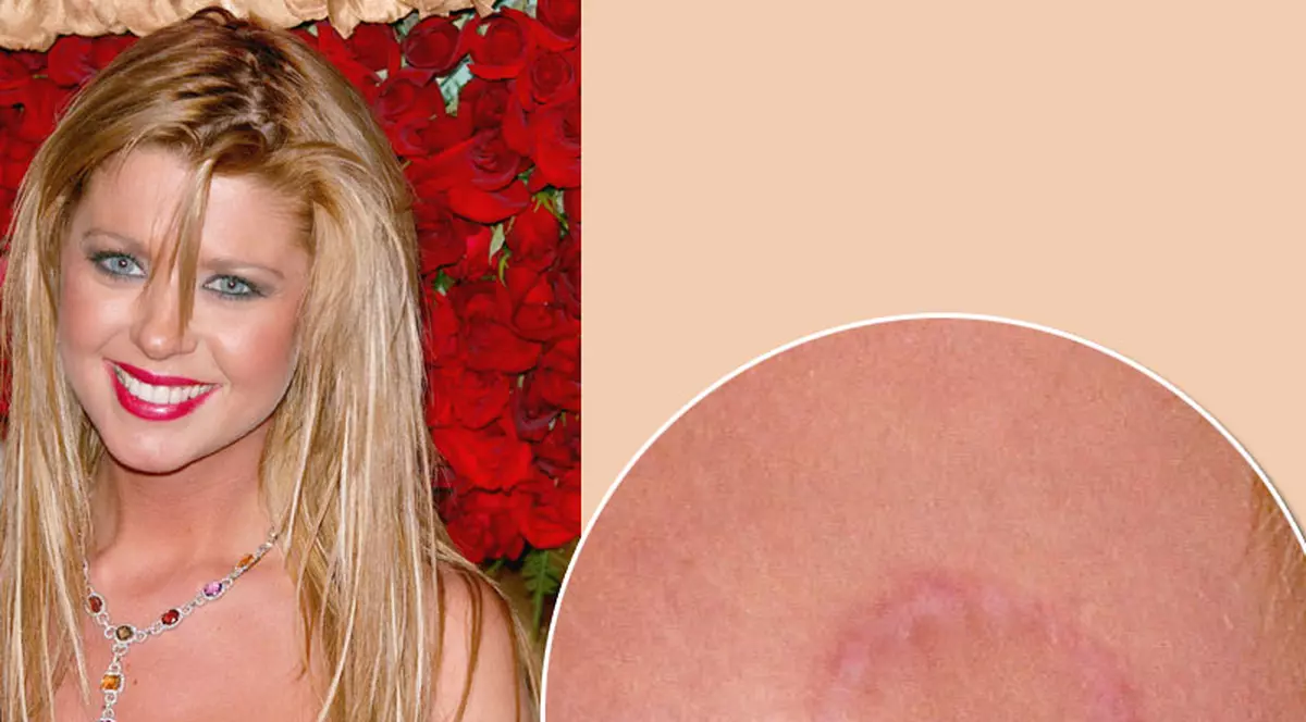 Înainte şi după silicoane: Tara Reid