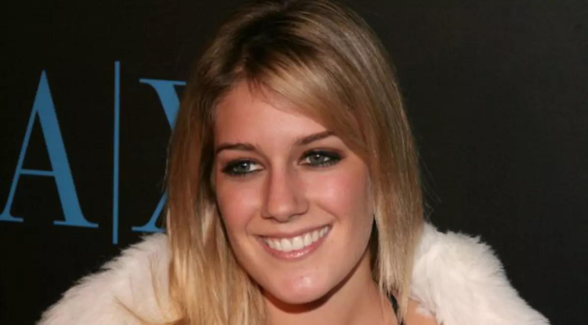 Înainte şi după silicoane: Heidi Montag