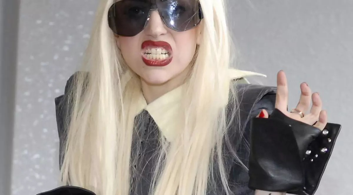 Lady Gaga, testată pentru lupus din cauza oboselii
