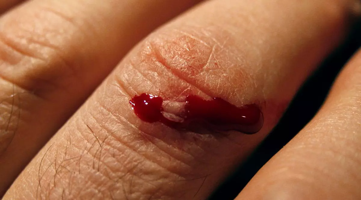 L-a muşcat pe poliţist de deget