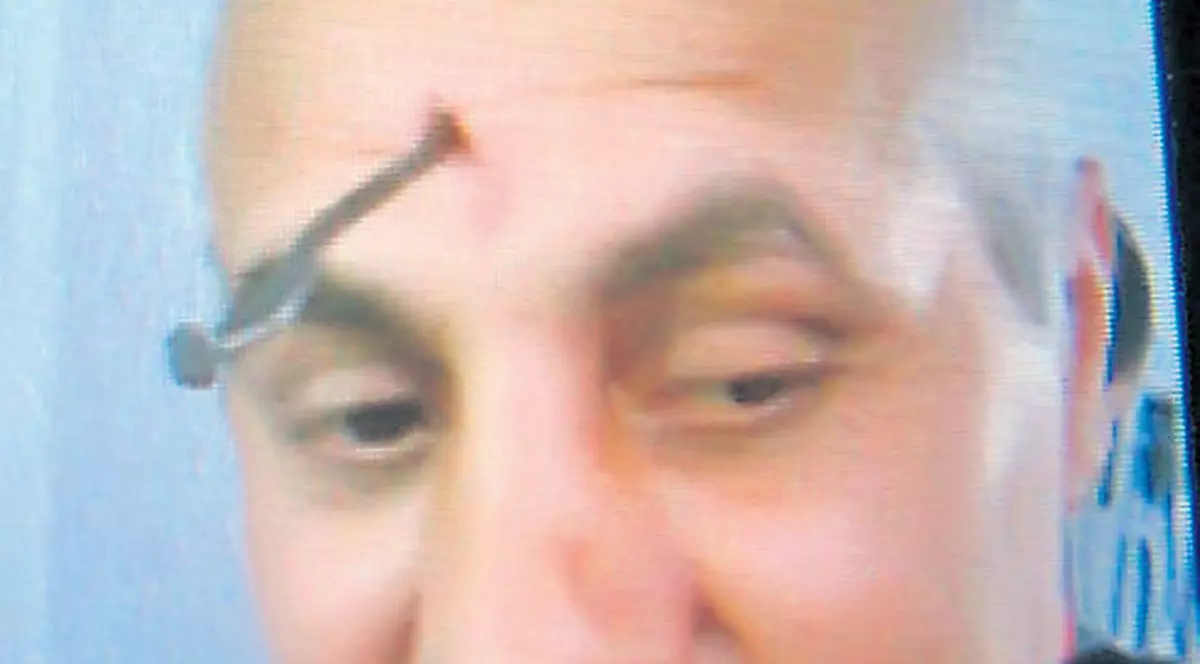 Supărat pe şeful penitenciarului, un deţinut din Galaţi şi-a bătut un cui în cap