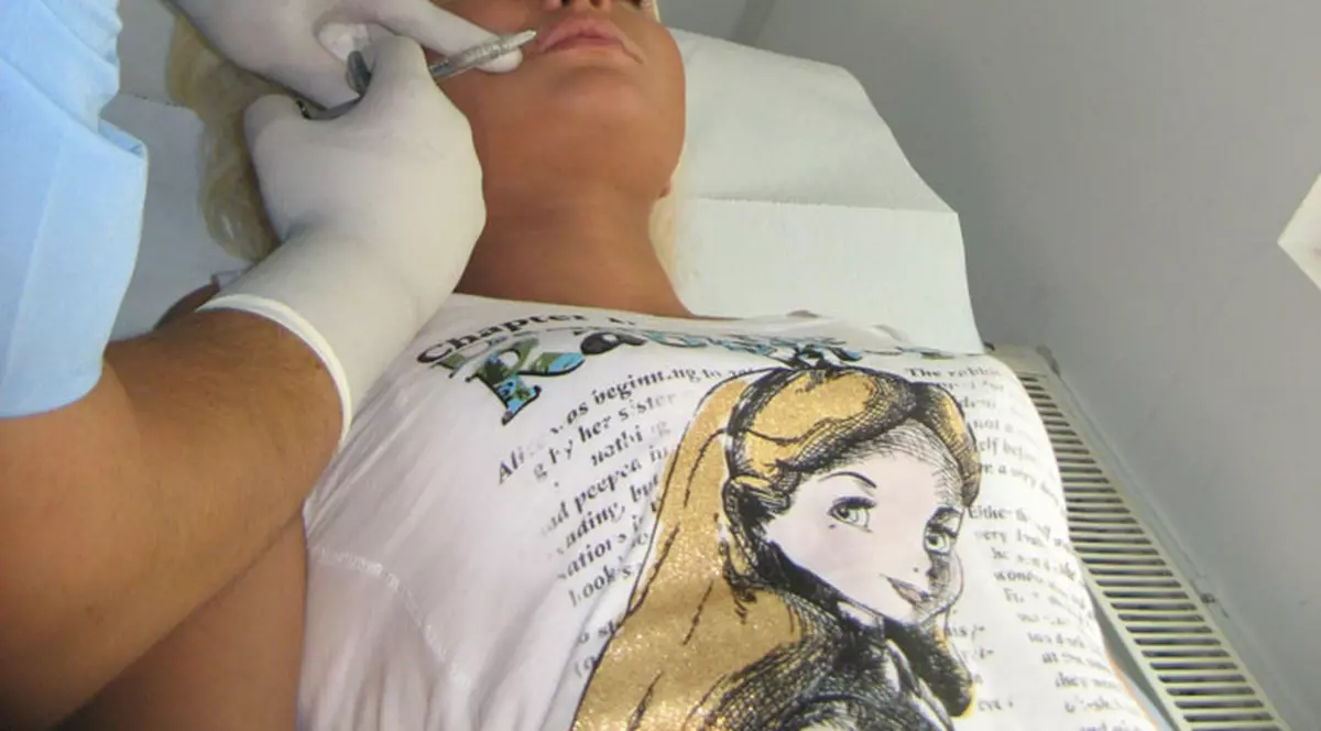 Elena Matei şi-a mărit buzele