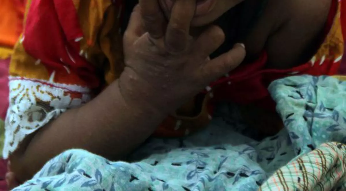 Imaginea zilei | Copiii din Pakistan mor din cauza lipsei apei potabile