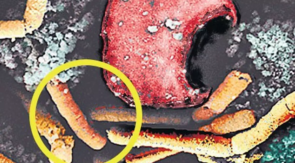 Îmbolnăviri cu antrax în Bangladesh