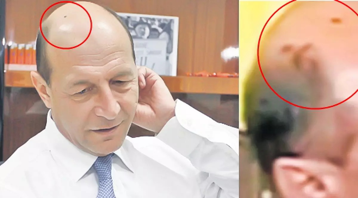 «Băse, cu 300 de lei te scap de pete!»