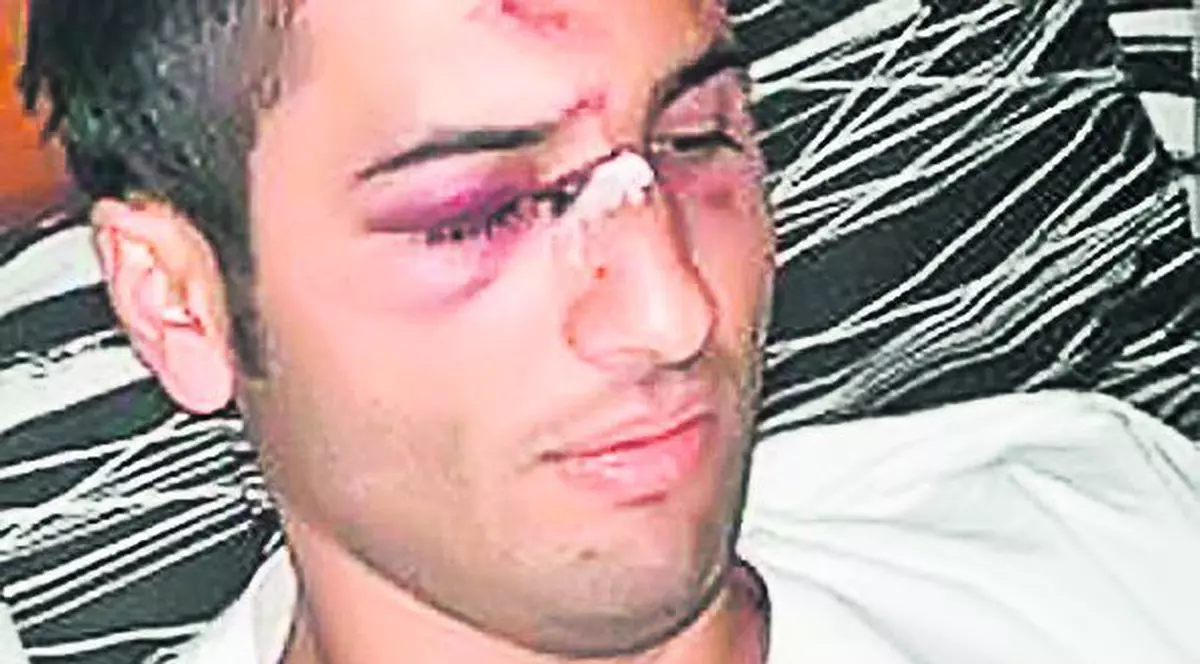 Racaj Berat, ospătarul agresat sâmbătă noaptea de «Briliant»: «Mutu m-a rupt în bătaie»