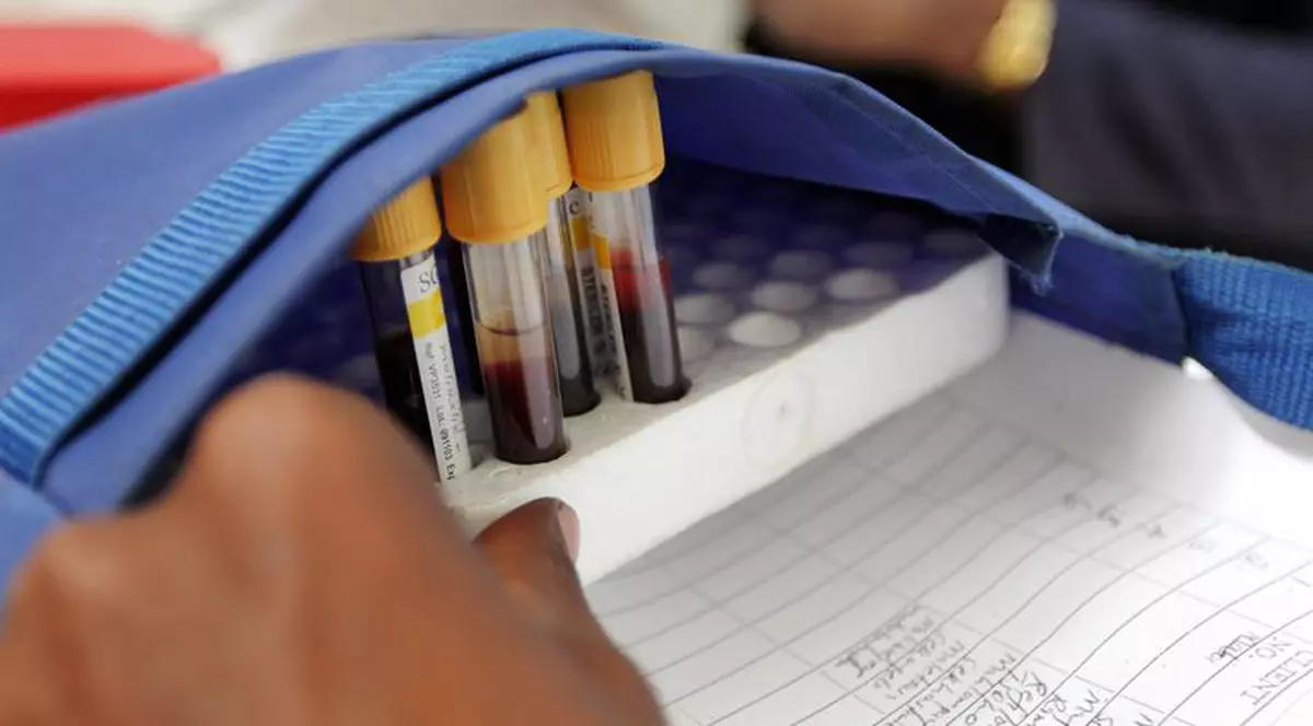 Rusia testează trei vaccinuri contra HIV