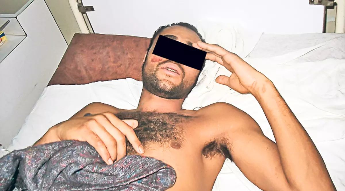 Un congolez se consideră o victimă a magiei negre: «Vrăjitoarele m-au aruncat de la etajul 4»