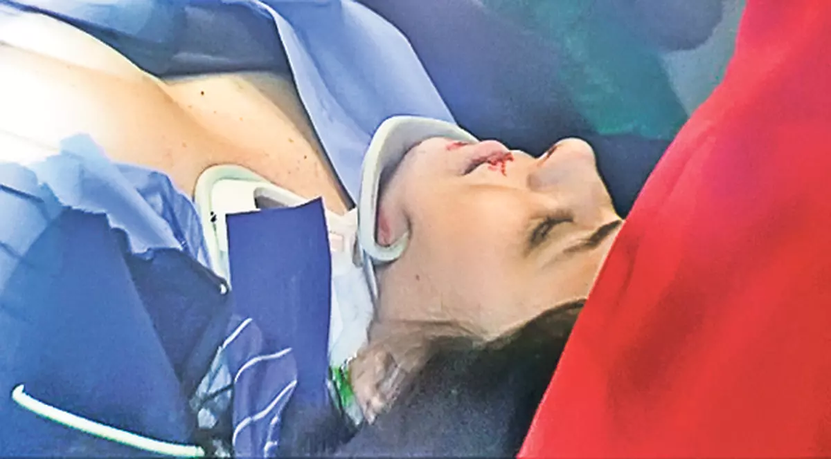 Femeia accidentată grav de «tramvaiul ucigaş» din Iaşi, urmărită de nenorociri