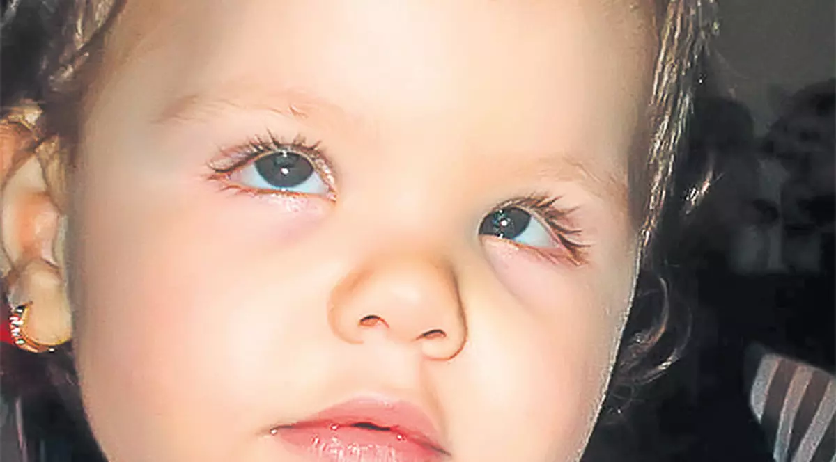 Scrisoarea săptămânii | «Ajutaţi-o pe Anemona să se bucure de copilărie!»