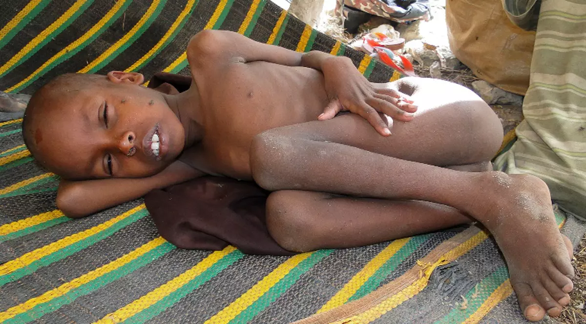 Catastrofă umanitară decretată de ONU în Somalia