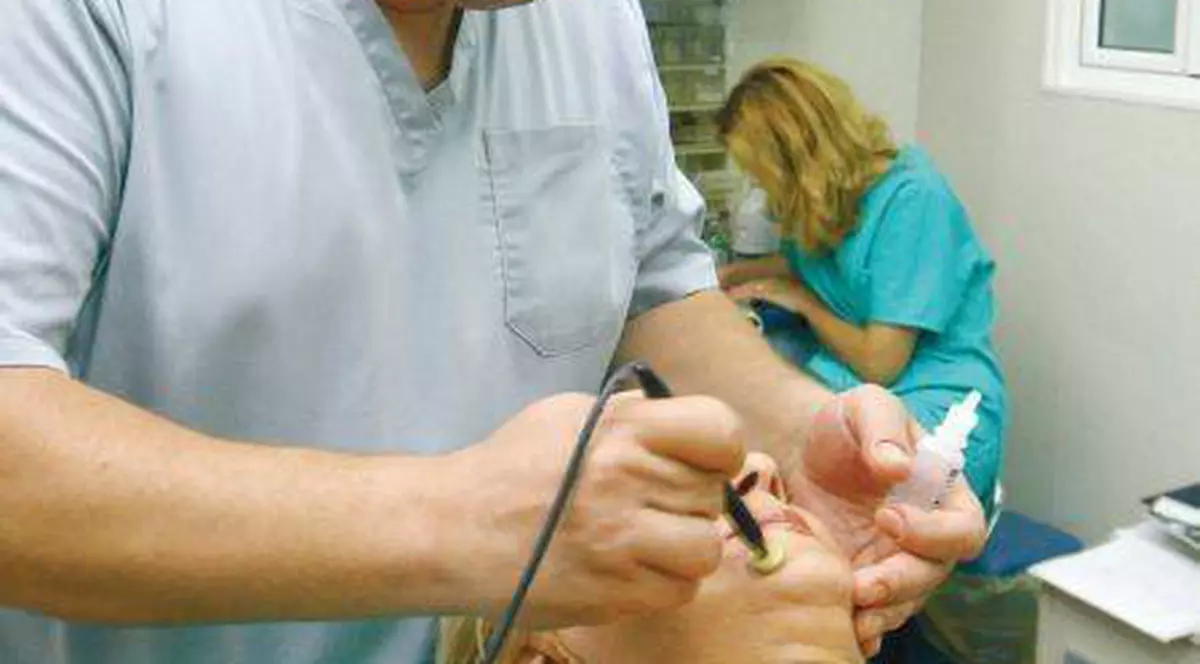 Radiofrecvenţa te scapă de vergeturi